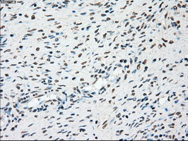 PLK1 / PLK-1 Antibody - IHC of paraffin-embedded Ovary tissue using anti-PLK1 mouse monoclonal antibody. (Dilution 1:50).
