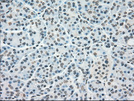 PLK1 / PLK-1 Antibody - IHC of paraffin-embedded pancreas tissue using anti-PLK1 mouse monoclonal antibody. (Dilution 1:50).
