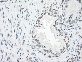 PLK1 / PLK-1 Antibody - IHC of paraffin-embedded prostate tissue using anti-PLK1 mouse monoclonal antibody. (Dilution 1:50).