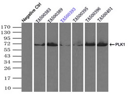 PLK1 / PLK-1 Antibody - Immunoprecipitation(IP) of PLK1 by using monoclonal anti-PLK1 antibodies (Negative control: IP without adding anti-PLK1 antibody.). For each experiment, 500ul of DDK tagged PLK1 overexpression lysates (at 1:5 dilution with HEK293T lysate), 2 ug of anti-PLK1 antibody and 20ul (0.1 mg) of goat anti-mouse conjugated magnetic beads were mixed and incubated overnight. After extensive wash to remove any non-specific binding, the immuno-precipitated products were analyzed with rabbit anti-DDK polyclonal antibody.