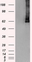 PLK1 / PLK-1 Antibody - HEK293T cells were transfected with the pCMV6-ENTRY control (Left lane) or pCMV6-ENTRY PLK1 (Right lane) cDNA for 48 hrs and lysed. Equivalent amounts of cell lysates (5 ug per lane) were separated by SDS-PAGE and immunoblotted with anti-PLK1.