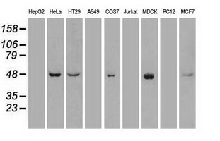 PLK1 / PLK-1 Antibody - Western blot of extracts (35 ug) from 9 different cell lines by using anti-PLK1 monoclonal antibody.