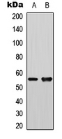 PLK1 / PLK-1 Antibody - Western blot analysis of PLK1 expression in HeLa (A); mouse hippocampal homogenate (B) whole cell lysates.