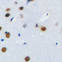 PLK1 / PLK-1 Antibody - Immunohistochemical analysis of PLK1 staining in human brain formalin fixed paraffin embedded tissue section. The section was pre-treated using heat mediated antigen retrieval with sodium citrate buffer (pH 6.0). The section was then incubated with the antibody at room temperature and detected using an HRP conjugated compact polymer system. DAB was used as the chromogen. The section was then counterstained with hematoxylin and mounted with DPX.