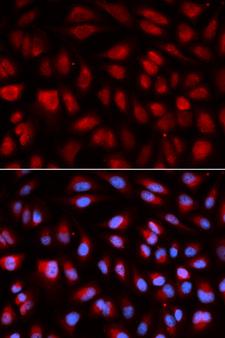 PLK1 / PLK-1 Antibody - Immunofluorescence analysis of U2OS cells.