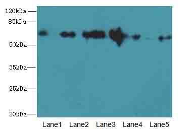 PLK1 / PLK-1 Antibody - Western blot. All lanes: PLK1 antibody at 3 ug/ml. Lane 1: A375 whole cell lysate. Lane 2: Colo320 whole cell lysate. Lane 3: Human placenta tissue. Lane 4: HeLa whole cell lysate. Lane 5: A431 whole cell lysate. Secondary Goat polyclonal to Rabbit IgG at 1:10000 dilution. Predicted band size: 68 kDa. Observed band size: 68 kDa.