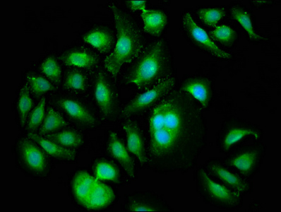 PLK1 / PLK-1 Antibody - Immunofluorescence staining of A549 cells with PLK1 Antibody at 1:133, counter-stained with DAPI. The cells were fixed in 4% formaldehyde, permeabilized using 0.2% Triton X-100 and blocked in 10% normal Goat Serum. The cells were then incubated with the antibody overnight at 4°C. The secondary antibody was Alexa Fluor 488-congugated AffiniPure Goat Anti-Rabbit IgG(H+L).
