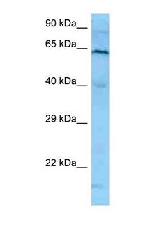 PLK1 / PLK-1 Antibody - PLK1 antibody Western blot of HeLa Cell lysate. Antibody concentration 1 ug/ml.  This image was taken for the unconjugated form of this product. Other forms have not been tested.