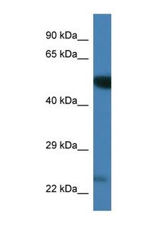 PLK3 Antibody - PLK3 antibody Western blot of Mouse Brain lysate. Antibody concentration 1 ug/ml. This image was taken for the unconjugated form of this product. Other forms have not been tested.