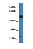 PLK3 Antibody - PLK3 antibody Western blot of Mouse Brain lysate. Antibody concentration 1 ug/ml. This image was taken for the unconjugated form of this product. Other forms have not been tested.