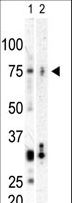 PLK3 Antibody - Western blot of anti-CNK antibody in SK-BR3 cell lysate (Lane A) and mouse heart tissue lysate (Lane B). CNK (arrow) was detected using purified antibody. Secondary HRP-anti-rabbit was used for signal visualization with chemiluminescence.
