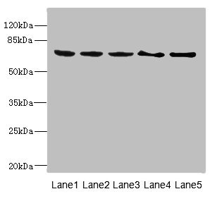 PLK3 Antibody - Western blot All Lanes: PLK3 antibody at 1.2ug/ml Lane 1: Rat heart tissue Lane 2: Hela whole cell lysate Lane 3: 293T whole cell lysate Lane 4: MCF7 whole cell lysate Lane 5: Monocytic leukemia cells in mice Macrophages Secondary Goat polyclonal to rabbit IgG at 1/10000 dilution Predicted band size: 72 kDa Observed band size: 72 kDa