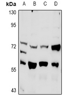 PLK3 Antibody - Western blot analysis of PLK3 expression in PC12 (A), CT26 (B), A549 (C), H1792 (D) whole cell lysates.
