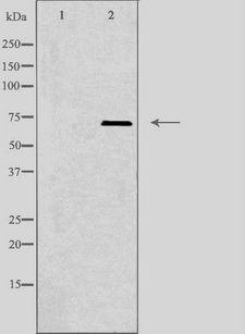 PLK3 Antibody - Western blot analysis of extracts of HepG2 cells using PLK3 antibody. The lane on the left is treated with the antigen-specific peptide.
