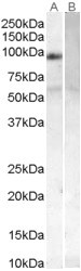 PLK4 / SAK Antibody - Antibody (0.1 ug/ml) staining of Human Placenta lysate (35 ug protein in RIPA buffer) with (B) and without (A) blocking with the immunizing peptide. Primary incubation was 1 hour. Detected by chemiluminescence.