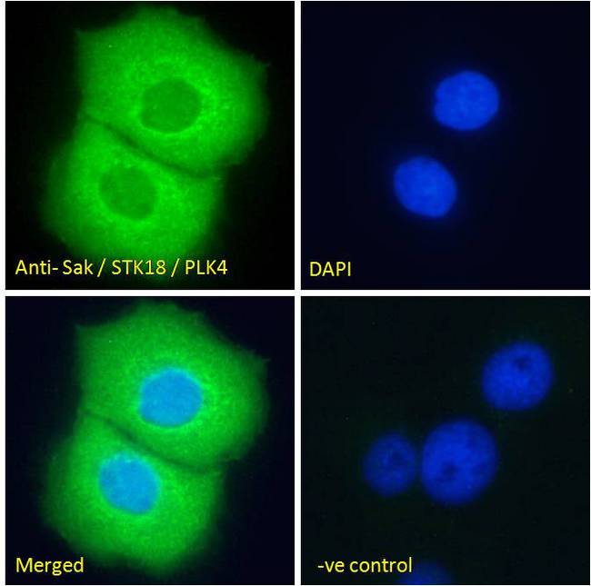 PLK4 / SAK Antibody - Sak / STK18 / PLK4 Antibody Immunofluorescence analysis of paraformaldehyde fixed A431 cells, permeabilized with 0.15% Triton. Primary incubation 1hr (10ug/ml) followed by Alexa Fluor 488 secondary antibody (2ug/ml), showing cytoplasmic staining. The nuclear stain is DAPI (blue). Negative control: Unimmunized goat IgG (10ug/ml) followed by Alexa Fluor 488 secondary antibody (2ug/ml).