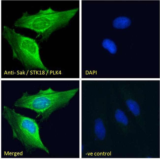 PLK4 / SAK Antibody - Sak / STK18 / PLK4 Antibody Immunofluorescence analysis of paraformaldehyde fixed HeLa cells, permeabilized with 0.15% Triton. Primary incubation 1hr (10ug/ml) followed by Alexa Fluor 488 secondary antibody (2ug/ml), showing cytoplasmic staining. The nuclear stain is DAPI (blue). Negative control: Unimmunized goat IgG (10ug/ml) followed by Alexa Fluor 488 secondary antibody (2ug/ml).