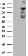 PLK4 / SAK Antibody - HEK293T cells were transfected with the pCMV6-ENTRY control. (Left lane) or pCMV6-ENTRY PLK4. (Right lane) cDNA for 48 hrs and lysed. Equivalent amounts of cell lysates. (5 ug per lane) were separated by SDS-PAGE and immunoblotted with anti-PLK4. (1:500)
