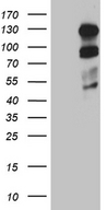 PLK4 / SAK Antibody - HEK293T cells were transfected with the pCMV6-ENTRY control. (Left lane) or pCMV6-ENTRY PLK4. (Right lane) cDNA for 48 hrs and lysed