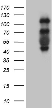 PLK4 / SAK Antibody - HEK293T cells were transfected with the pCMV6-ENTRY control. (Left lane) or pCMV6-ENTRY PLK4. (Right lane) cDNA for 48 hrs and lysed