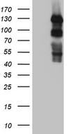 PLK4 / SAK Antibody - HEK293T cells were transfected with the pCMV6-ENTRY control. (Left lane) or pCMV6-ENTRY PLK4. (Right lane) cDNA for 48 hrs and lysed. Equivalent amounts of cell lysates. (5 ug per lane) were separated by SDS-PAGE and immunoblotted with anti-PLK4. (1:2000)