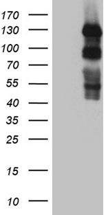 PLK4 / SAK Antibody - HEK293T cells were transfected with the pCMV6-ENTRY control. (Left lane) or pCMV6-ENTRY PLK4. (Right lane) cDNA for 48 hrs and lysed