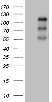 PLK4 / SAK Antibody - HEK293T cells were transfected with the pCMV6-ENTRY control. (Left lane) or pCMV6-ENTRY PLK4. (Right lane) cDNA for 48 hrs and lysed