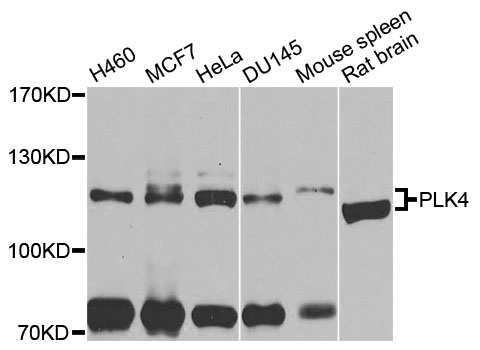 PLK4 / SAK Antibody - Western blot analysis of extracts of various cell lines.