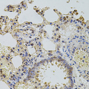 PLK4 / SAK Antibody - Immunohistochemistry of paraffin-embedded rat lung tissue.