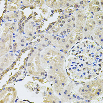 PLK4 / SAK Antibody - Immunohistochemistry of paraffin-embedded rat kidney tissue.