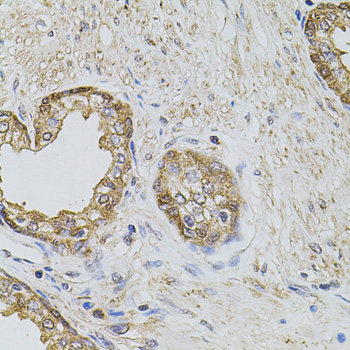 PLK4 / SAK Antibody - Immunohistochemistry of paraffin-embedded human prostate tissue.