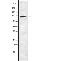 PLK4 / SAK Antibody - Western blot analysis of PLK4 using COS7 whole cells lysates