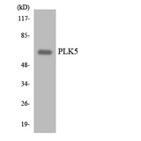 PLK5 Antibody - Western blot analysis of the lysates from HeLa cells using PLK5 antibody.