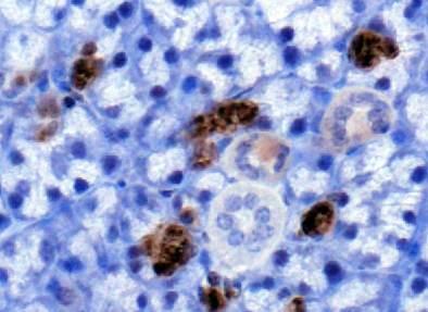 PLK5 Antibody - Immunohistochemistry: PLK5 Antibody - IHC analysis of PLK5 in mouse salivary gland using DAB with hematoxylin counterstain.  This image was taken for the unconjugated form of this product. Other forms have not been tested.