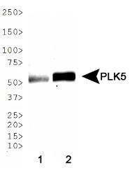 PLK5 Antibody - Western Blot: PLK5 Antibody - WB analysis of PLK5 in 1. human brain lysate and 2. mouse brain lysate. Molecular weight of PLK5 differs between human and mouse species.  This image was taken for the unconjugated form of this product. Other forms have not been tested.