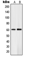 PLK5 Antibody - Western blot analysis of PLK5 expression in Jurkat (A); human brain (B) whole cell lysates.