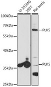 PLK5 Antibody - Western blot analysis of extracts of various cell lines, using PLK5 antibody at 1:1000 dilution. The secondary antibody used was an HRP Goat Anti-Rabbit IgG (H+L) at 1:10000 dilution. Lysates were loaded 25ug per lane and 3% nonfat dry milk in TBST was used for blocking. An ECL Kit was used for detection and the exposure time was 60s.