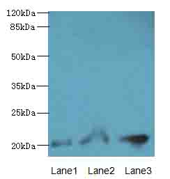 PLLP / Plasmolipin Antibody - Western blot. All lanes: PLLP antibody at 4 ug/ml. Lane 1: Mouse gonadal tissue. Lane 2: Mouse kidney tissue. Lane 3: Mouse lung tissue. Secondary Goat polyclonal to Rabbit IgG at 1:10000 dilution. Predicted band size: 20 kDa. Observed band size: 20 kDa.