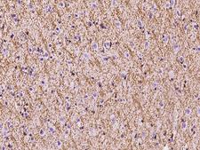 PLLP / Plasmolipin Antibody - Immunochemical staining of human PLLP in human brain with rabbit polyclonal antibody at 1:100 dilution, formalin-fixed paraffin embedded sections.