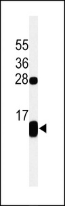 PLN / Phospholamban Antibody - Western blot of PLB-T17 in Jurkat cell line lysates (35 ug/lane). PLB (arrow) was detected using the purified antibody.