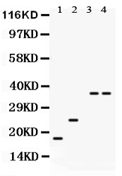 PLN / Phospholamban Antibody - PLN antibody Western blot. All lanes: Anti PLN at 0.5 ug/ml. Lane 1: Mouse Cardiac Muscle Tissue Lysate at 50 ug. Lane 2: Rat Cardiac Muscle Tissue Lysate at 50 ug. Lane 3: COLO320 Whole Cell Lysate at 40 ug. Lane 4: K562 Whole Cell Lysate at 40 ug. Predicted band size: 6 kD. Observed band size: 18, 24, 36 kD.