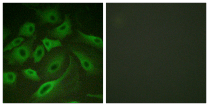 PLN / Phospholamban Antibody - Immunofluorescence analysis of HeLa cells, using PLB Antibody. The picture on the right is blocked with the synthesized peptide.