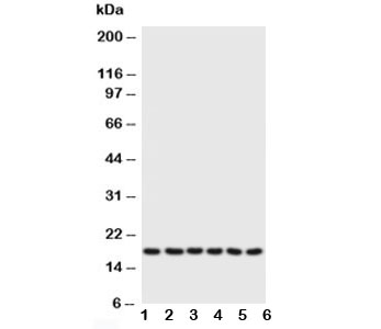 PLN / Phospholamban Antibody - Western blot testing of Phospholamban antibody and Lane 1: rat heart; 2: rat heart; 3: CEM; 4: MCF-7; 5: HT1080; 6: HeLa; Predicted size: 18KD; Observed size: 18KD