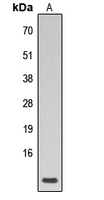PLN / Phospholamban Antibody - Western blot analysis of Phospholamban (pS16/T17) expression in human heart (A) whole cell lysates.