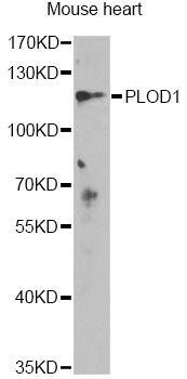 PLOD / PLOD1 Antibody - Western blot analysis of extracts of mouse heart, using PLOD1 antibody at 1:1000 dilution. The secondary antibody used was an HRP Goat Anti-Rabbit IgG (H+L) at 1:10000 dilution. Lysates were loaded 25ug per lane and 3% nonfat dry milk in TBST was used for blocking. An ECL Kit was used for detection and the exposure time was 60s.