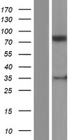 PLOD / PLOD1 Protein - Western validation with an anti-DDK antibody * L: Control HEK293 lysate R: Over-expression lysate