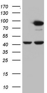PLOD2 Antibody - HEK293T cells were transfected with the pCMV6-ENTRY control (Left lane) or pCMV6-ENTRY PLOD2 (Right lane) cDNA for 48 hrs and lysed. Equivalent amounts of cell lysates (5 ug per lane) were separated by SDS-PAGE and immunoblotted with anti-PLOD2.