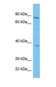 PLOD2 Antibody - Western blot of PLOD2 Antibody with human HepG2 Whole Cell lysate.  This image was taken for the unconjugated form of this product. Other forms have not been tested.