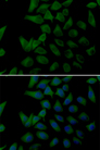 PLOD2 Antibody - Immunofluorescence analysis of U20S cells.