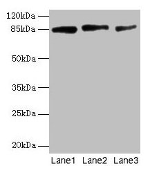 PLOD2 Antibody - Western Blot All lanes: PLOD2 antibody at 12µg/ml Lane 1: U87 whole cell lysate Lane 2: U251 whole cell lysate Lane 3: 293T whole cell lysate Secondary Goat polyclonal to rabbit IgG at 1/10000 dilution Predicted band size: 85, 88, 50 kDa Observed band size: 85 kDa